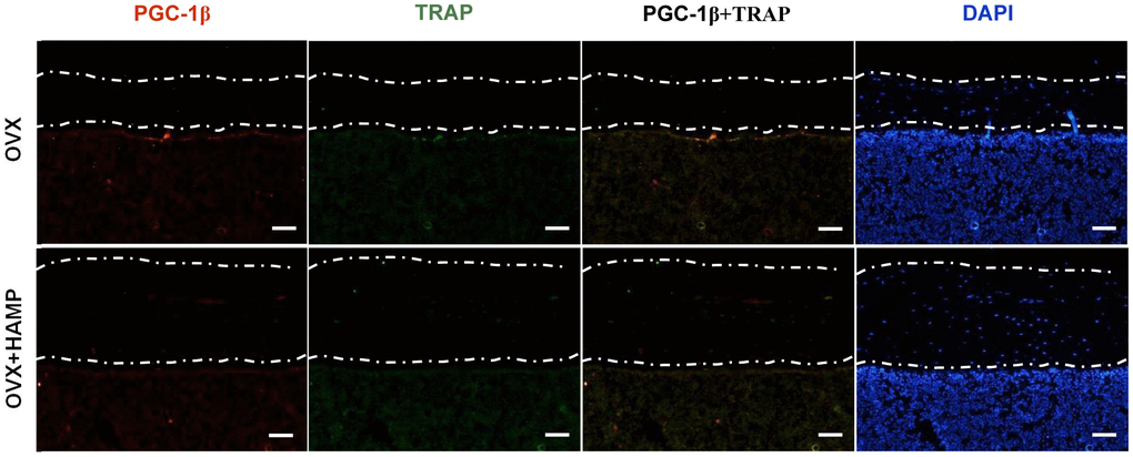 Overexpression hepcidin decreases PGC-1β expression in OVX mouse bone. The expression of PGC-1β in bone was evaluated by immunohistofluorescence assays in overexpression hepcidin and non-overexpression hepcidin OVX mouse bone. Scale bar, 50 μm.