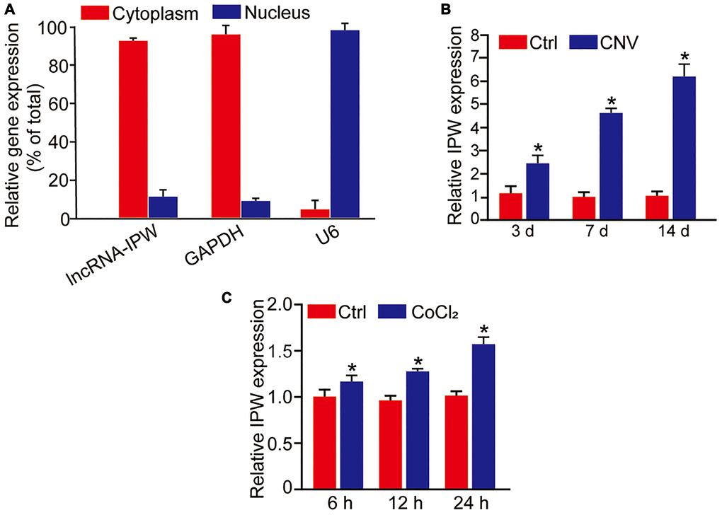 LncRNA-IPW is significantly up-regulated in laser-induced CNV lesions and endothelial cells upon hypoxic stress. (A) The expression of nucleus control transcript (U6), cytoplasm control transcript (GAPDH), and IPW was detected by qRT-PCRs in the nucleus and cytoplasm fractions of RF/6A cells (n = 4). (B) qRT-PCRs were performed to detect the expression of IPW in the RPE/choroid complex of C57BL/6J mice on day 3, day 7, and day 14 after laser photocoagulation (n = 5 animal per group; *P U test). (C) RF/6A cells were exposed to 200 μM CoCl2 for the indicated time points. qRT-PCRs were performed to detect the expression of IPW (n = 4; *P t-test).