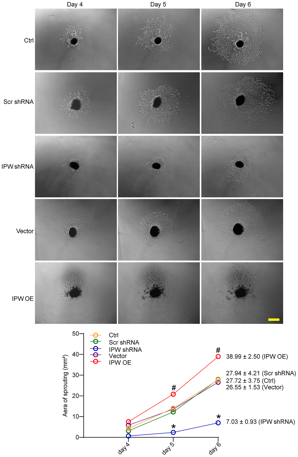 LncRNA-IPW regulates choroidal sprouting in ex vivo explant model. C57BL/6 mice received an intravitreal injection of Scr shRNA, IPW shRNA, vehicle (Vector), IPW overexpression vector (IPW OE), or left untreated (Ctrl, A-C). On day 14, RPE/choroid complexes were dissected. The peripheral regions of RPE complexes were cut into 1 mm × 1 mm pieces and seeded. The sprouting potency of choroidal explants were photographed on day 4, day 5, and day 6 (n = 6; Kruskal-Wallis test). The representative images of choroidal sprouting were shown. Meanwhile, the quantification results of sprouting area were shown. Scale bar: 1 mm.*P #P 