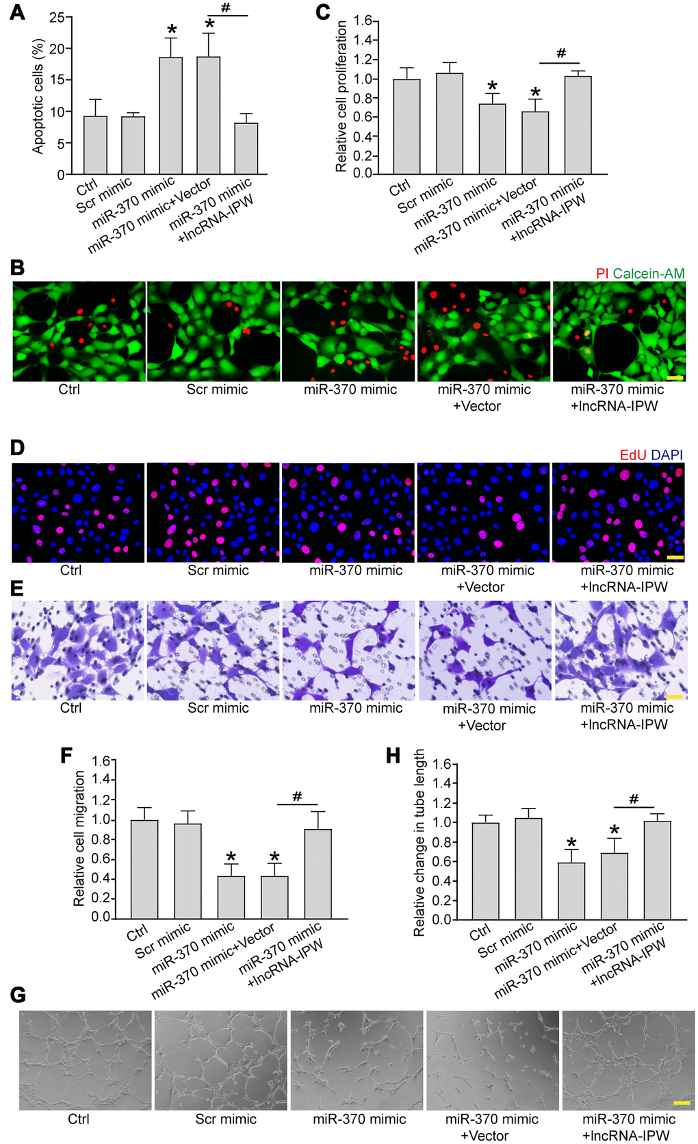 LncRNA-IPW/miR-370 interaction regulates endothelial angiogenic function in vitro. (A and B) RF/6A cells were transfected with scrambled (Scr) mimic, miR-370 mimic, miR-370 mimic plus pcDNA3.0 vector (Vector), miR-370 mimic plus pcDNA3.0-IPW, or left untreated (Ctrl) for 24 h, and then exposed with CoCl2 (200 μmol/L) to mimic hypoxic stress for 24 h. Apoptotic cells were determined by PI/Calcein-AM staining and quantified. Green: live cells; red: dead or dying cells. Scale bar: 50 μm (n = 4; *P #P C–H) RF/6A cells were transfected with Scr mimic, miR-370 mimic, miR-370 mimic plus pcDNA3.0 vector, miR-370 mimic plus pcDNA3.0-IPW, or left untreated (Ctrl) for 24 h. Cell proliferation was detected by EdU staining and quantified. DAPI, blue; EdU, red. Scale bar: 20 μm (C and D; n = 4; *P #P n = 4; *P #P n = 4; *P #P 