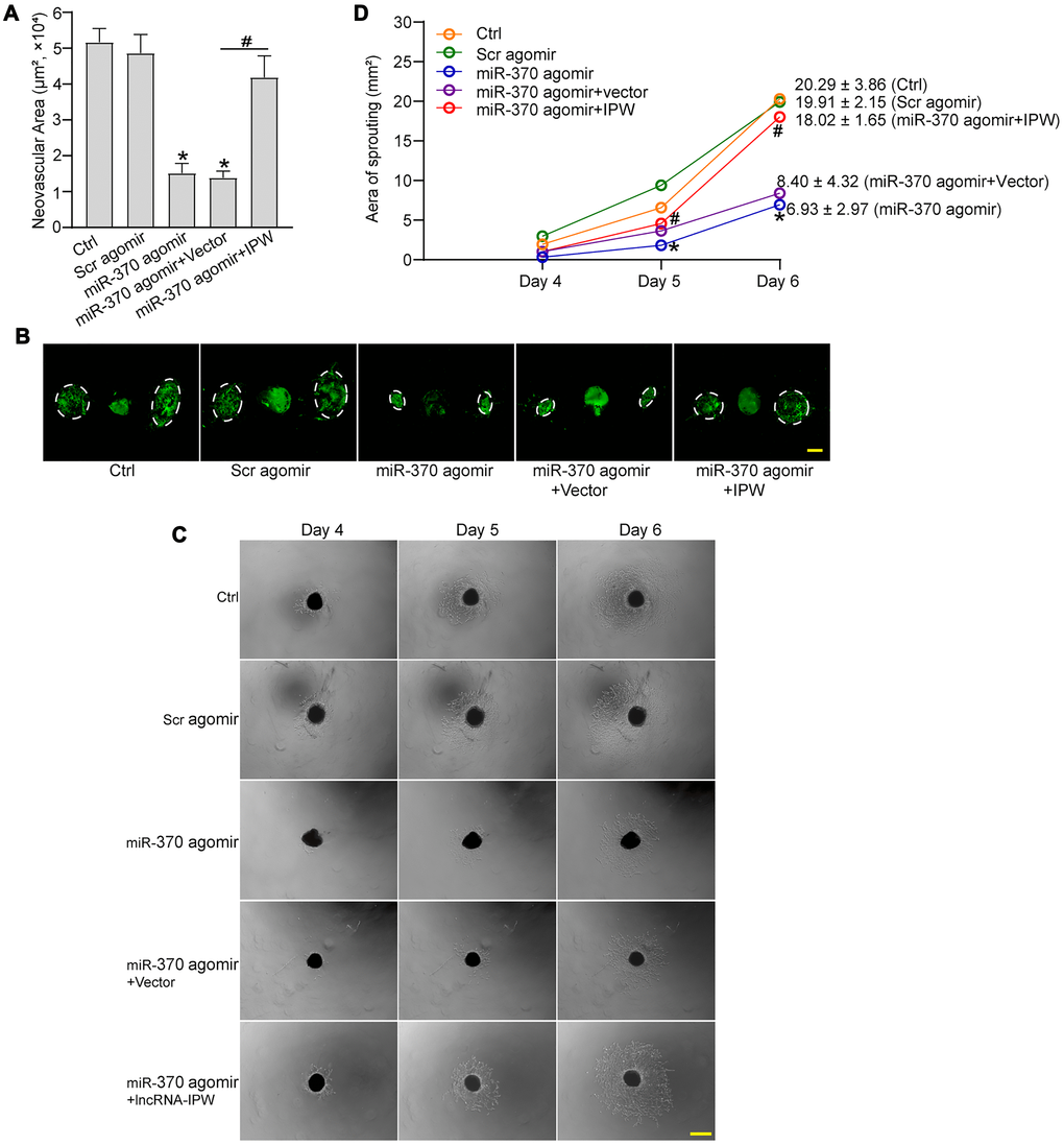 LncRNA-IPW/miR-370 interaction regulates the development of CNV in vivo and ex vivo. (A and B) The mice were injected with scrambled (Scr) agomir, miR-370 agomir, miR-370 agomir plus AAV vector, miR-370 agomir plus AAV-IPW, or left untreated (Ctrl). On day 14 after laser photocoagulation, the mice were euthanized and RPE/choroid complexes were dissected and flat-mounted. The blood vessels were stained with Isolectin-B4 (n = 6 animals/group; *P #P C and D) The mice received an intravitreal injection of Scr agomir, miR-370 agomir, miR-370 agomir plus Vector, miR-370 agomir plus IPW, or left untreated (Ctrl). On day 14 after laser photocoagulation, the RPE/choroid complexes were dissected and choroidal explants were performed as previously described. The representative images of choroidal explants after 4-day, 5-day, and 6-day culture were shown (C). Scale bar: 500 μm. Meanwhile, the quantification results of sprouting areas were shown (D; n = 6 animals/group; *P #P 