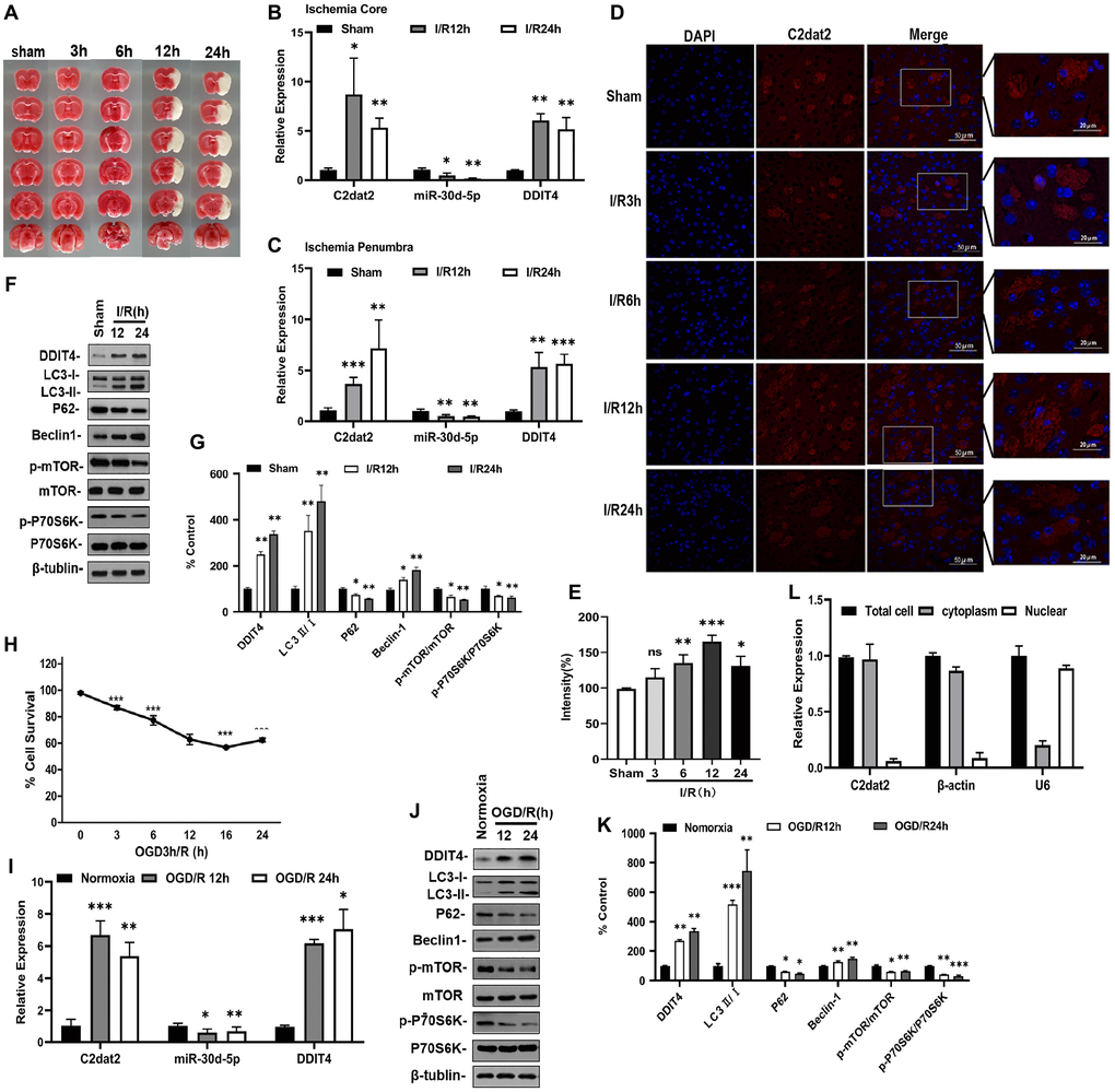 lncRNA C2dat2, miR-30d-5p, and DDIT4 were involved in the response to I/R-induced injury in vivo and in vitro. (A) Representative images of TTC-stained brain sections. Representative images in mice after 1 h MCAO and 3, 6, 12, 24, and 36 h reperfusion. (B–C) C2dat2, miR-30d-5p, and DDIT4 levels in the ischemic core (B) and penumbra (C) of ischemic and sham tissue were measured via RT-qPCR. GAPDH was used as the control (n = 3 per group). (D) Representative RNA-FISH images manifesting intracellular localization. (E) Intensity of C2dat2 in each group. (F) Western blotting showing the expression levels of DDIT4 and autophagy-related protein expression levels (LC3, P62, Beclin-1, p-mTOR, mTOR, p-P70S6K, and P70S6K) in the ischemia penumbra of mice after 1 h MCAO and 12 and 24 h reperfusion. (G) Relative protein levels were analyzed. Data are mean ± standard error of the mean (SEM; n = 3). (H) OGD/R-induced cell death in N2a cells. (I) RT-qPCR of C2dat2, DDIT4, and miR-30d-5p levels in OGD-treated cells and normoxia control. (J) Typical Western blotting results showed changes in DDIT4 and autophagy-related protein (LC3, P62, Beclin-1, p-mTOR, mTOR, p-P70S6K, and P70S6K) expression levels in N2a cells between normoxia and 12 and 24 h reoxygenation after 3 h OGD. (K) Relative protein levels were analyzed. Data are mean ± SEM (n = 3). β-Tubulin was blotted as a loading control. *P **P ***P L) Distribution of lncRNA C2dat2 in the cytoplasm and nucleus of N2a cells 24 h after OGD/R. Cell fractionation of U6, β-actin, and C2dat2 in N2a cells. Like β-actin, C2dat2 is expressed in the cytoplasm.