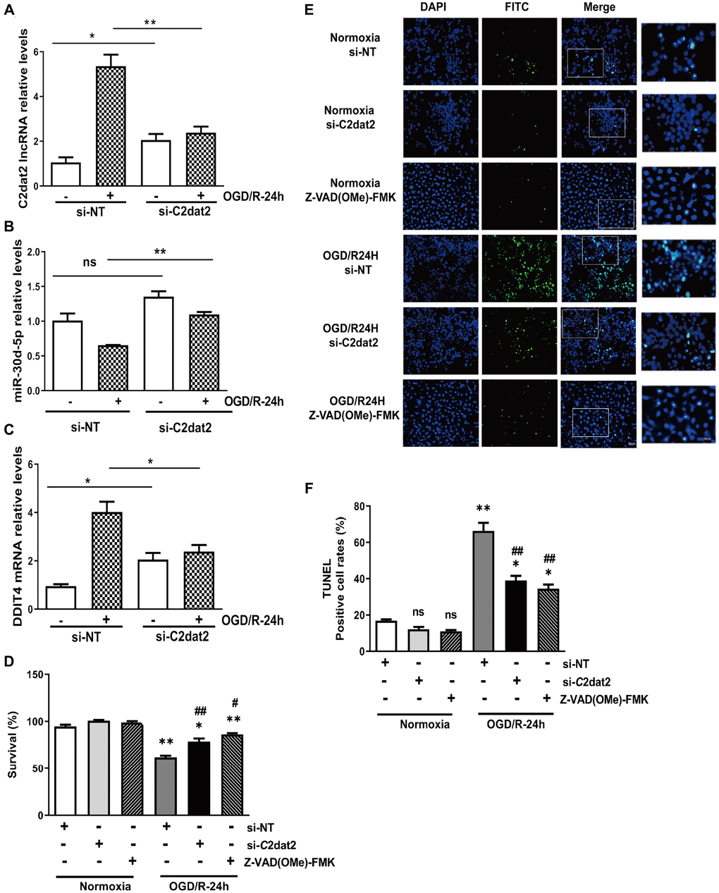 Effect of C2dat2 down-regulation on apoptosis in N2a cells after OGD/R. RT-qPCR manifested that C2dat2 knockdown abolished OGD/R-induced (A) C2dat2, (B) miR-30d-5p, and (C) DDIT4 expression in N2a cells. (D) Cell survival was examined by the CCK-8 assay after OGD/R with si-NT, si-C2dat2, or Z-VAD(OMe)-FMK (20 μM, 24 h) treatment. (E) Representative images of TUNEL staining after OGD/R with si-NT, si-C2dat2, or Z-VAD(OMe)-FMK (20 μM, 24 h) treatment. (F) TUNEL-positive cell rate in each group. *P **P #P ##P 