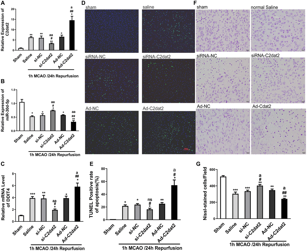 C2dat2 mediated a catalytic role in ischemic brain injury in vivo. (A–C) RT-qPCR showed the changes in (A) C2dat2, (B) miR-30d-5p, and (C) DDIT4 expression after infection with si-C2dat2 and Ad-C2dat2 in mice after 1 h MCAO and 24 h reperfusion. (D) Apoptosis in the ischemic penumbra was analyzed via TUNEL staining. Representative images showed TUNEL-positive cells in tissue from different groups. (E) Apoptotic rate in each group. (F) Representative images showing Nissl staining to determine neural cell loss in the ischemic penumbra. (G) Quantitative analysis of the effect of C2dat2 on neural cell loss. Data are mean ± SEM. *P **P #P ##P aP aaP n = 3 per group).