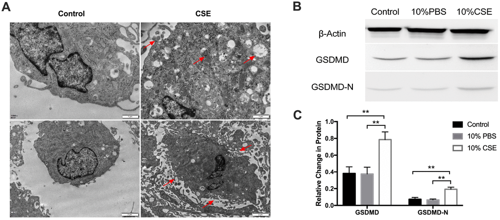 CSE treatment induced pyroptosis in HAECs. (A) Morphology of HAECs treated with and without CSE imaged using electron microscopy. Autophagosomes, cytoplasmic outflow and cell membrane break indicated by red arrows. (B, C) The protein levels of GSDMD and GSDMD-N were upregulated in HAECs after treatment with CSE, as indicated by western blot results. β-Actin was used as an internal control. **p n = 3).