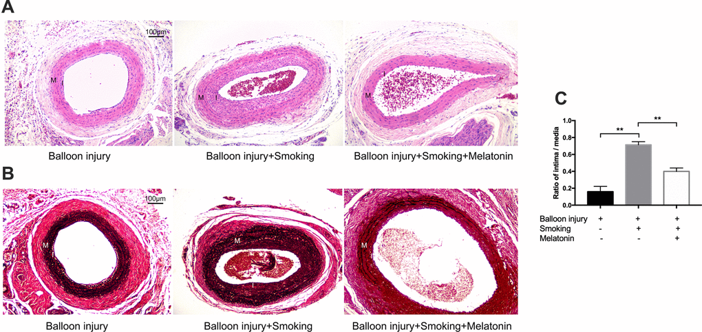 Melatonin reduced intimal hyperplasia of rat carotid artery after balloon injury with cigarette smoking. (A, B) H&E and VVG stained sections of carotid arteries of each group. Intima and media were labeled with "I" and "M" respectively. (C) Quantitative graphs of Intima to Media (I/M) ratio and intimal area. **p . The data are represented as mean ± SD (n = 3).