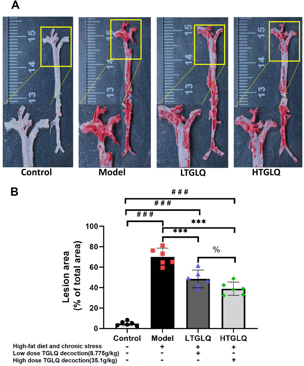 Oil red O staining of the whole aortic area. (A) Oil red O staining of the whole aortic area; (B) represents the percentage of measured lesion area. Oil red O staining to evaluate the severity of the lesions and quantify the atherosclerotic burden; the surface area of the oil red O-positive lesions on the surface of whole aorta was measured. Control group mice were fed with ordinary chow, while mice of the model group, the low-dose TGLQ-prescription (LTGLQ) group and the high-dose TGLQ prescription (HTGLQ) group were intragastrically injected with high-fat emulsion and stimulated with chronic stress. LTGLQ and HTGLQ group mice were intragastrically injected with 8.775g/kg and 35.1g/kg TGLQ prescription daily respectively. #, ##, and ### represent P P P P P P P 