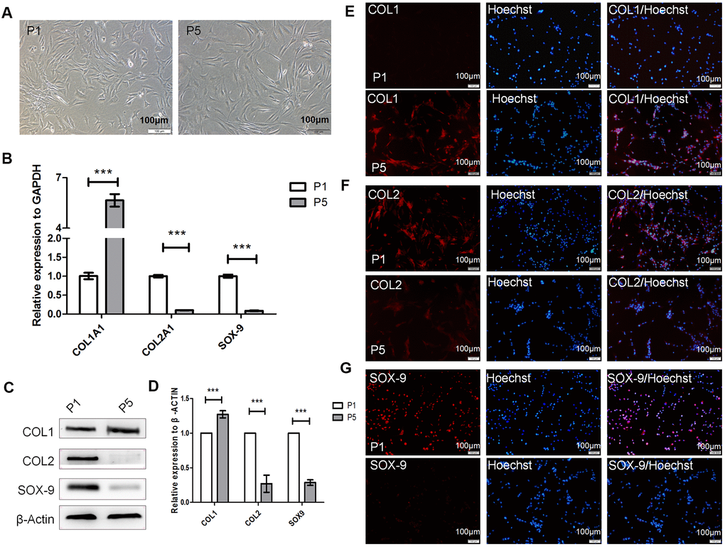 Dedifferentiation of human hyaline chondrocytes occurred during passage culture in vitro. (A) Morphological observations of passage 1 (P1) and P5 chondrocytes. (B) Real-time quantitative PCR (real-time qPCR) results for COL1A1 (alpha-1 type I collagen), COL2A1, and SOX9 expression in P1 and P5 chondrocytes. GAPDH (glyceraldehyde-3-phosphate dehydrogenase) was used as the internal reference. Data are represented as means ± standard deviation (n = 3). (C, D) Western blot analysis for COL1, COL2, and SOX-9 levels in P1 and P5 chondrocytes. β-actin was used as the internal reference. (E–G) Immunofluorescence staining of COL1, COL2, and SOX-9. P1 and P5 chondrocytes were stained with anti-COL2, anti-COL1, anti-SOX-9, and Hoechst 33342. *P P P 