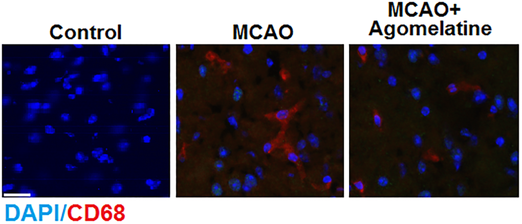 Agomelatine prevents macrophage infiltration in the cortex of the MCAO mouse model. Representative images of staining for macrophages using CD68 in the cerebral cortex 3 days post-tMCAO. Scale bar, 100 μM.