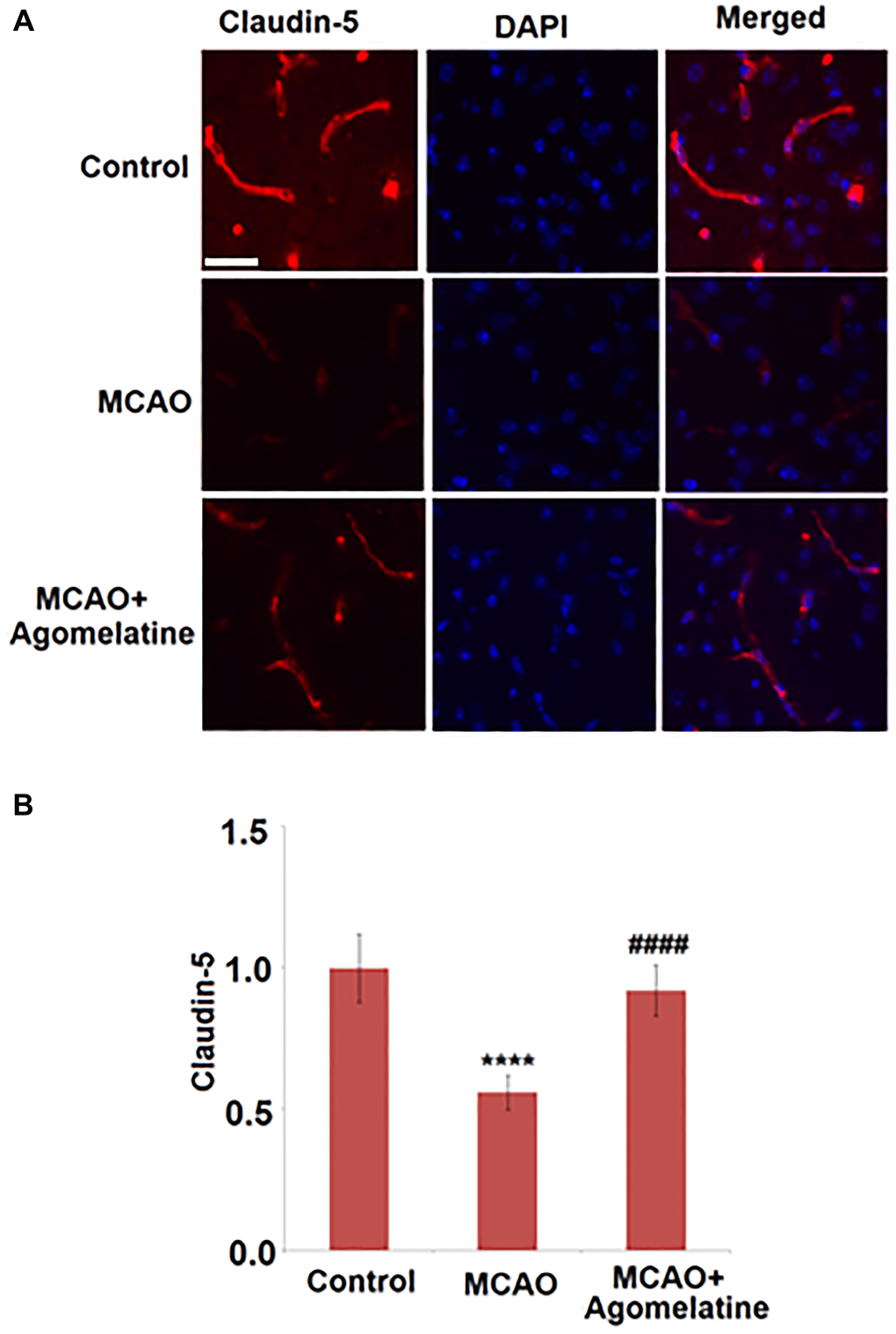 Agomelatine restored the reduction of tight junction protein expressions in the MCAO mouse model. (A). Representative images of staining for claudin-5 in the cerebral cortex 3 days post-tMCAO; (B). Quantification of claudin-5 staining. Scale bar, 100 μM (****P ####P 