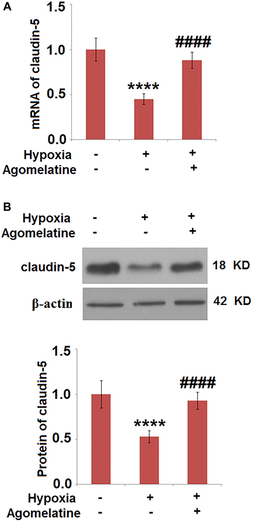 Agomelatine restored the expression of claudin-5 in hypoxic endothelial cells. Brain bEnd.3 endothelial cells were incubated with 10 μM Agomelatine in the process of hypoxia/ reperfusion (H/R). (A). mRNA of claudin-5 as measured by real-time PCR; (B). Protein expression of claudin-5 as measured by western blot analysis (****P ####P 