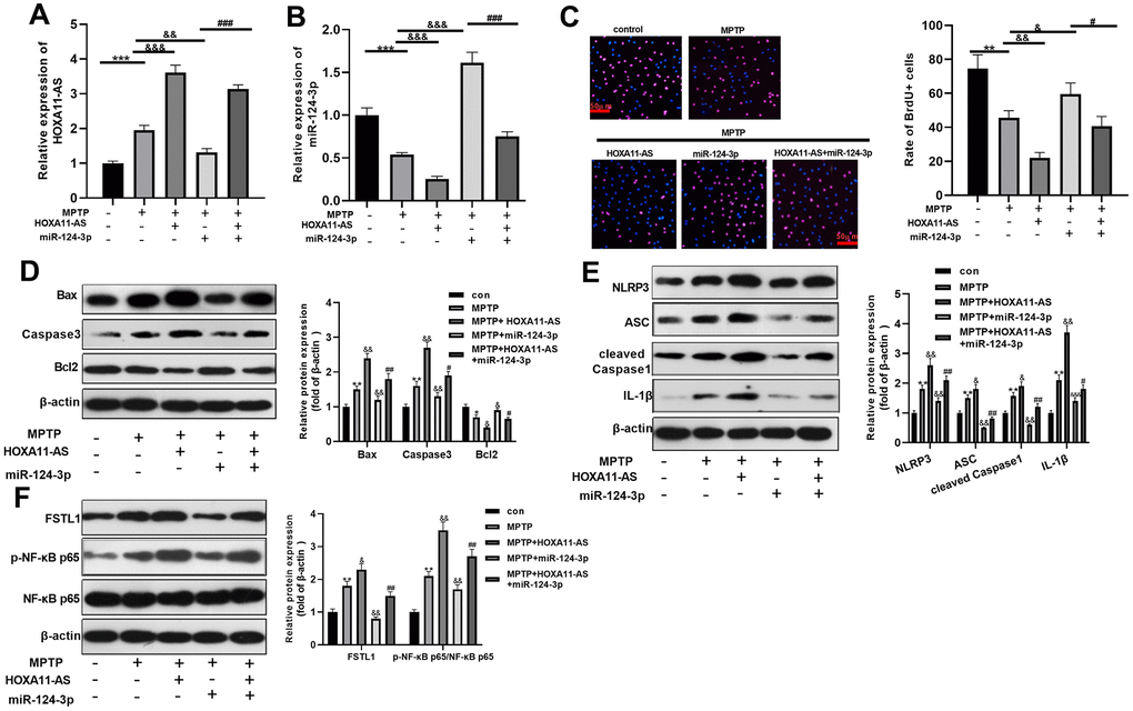 The effect of HOXA11-AS and miR-124-3p on MPTP-mediated SH-SY5Y neuronal damage. An in vitro model of PD was induced by MPTP on SH-SY5Y neuron cells. (A, B) RT-PCR was used to monitor HOXA11-AS and miR-124-3p expressions in SH-SY5Y cells. (C, D) Brdu and Western blot experiments were carried out to test cell viability and expression of apoptosis-related proteins in SH-SY5Y cells. (E, F) Western blot was applied to verify the protein expression of NLRP3 inflammasome, FSTL1 and p-NF-κB in SH-SY5Y cells. ** P P P P P P P 