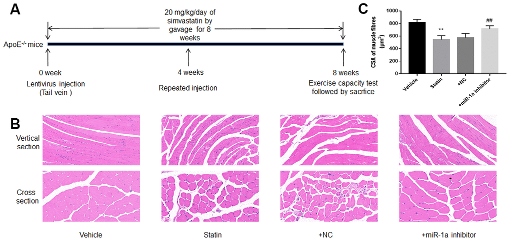 Downregulation of miR-1a prevents statin-induced morphological deterioration of gastrocnemius in ApoE-/- mice. (A) The protocol for animal experiments was shown. (B) The morphology of gastrocnemius muscle was observed by HE staining. (C) Quantitative analysis of fibre cross-sectional area (CSA) in gastrocnemius muscle from mice was performed. N is 10-15 in each group. **P ##Ppost-hoc tests was used to determine P value in (C).