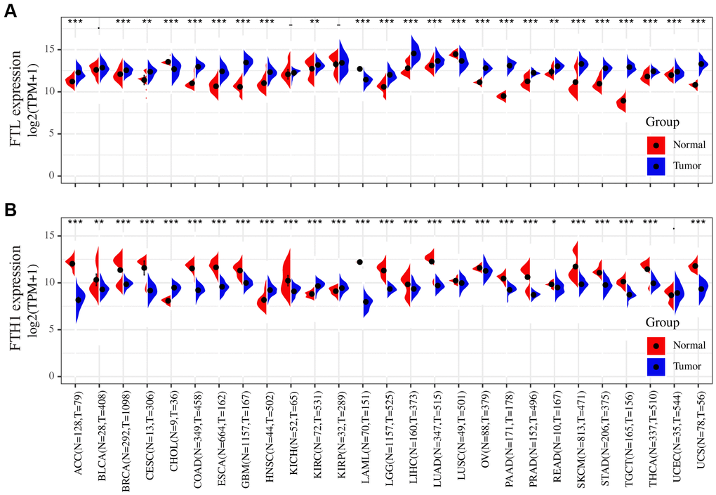 Differences in the FTL and FTH1 expressions between 27 tumors and corresponding normal tissues. (A) FTL level was up-regulated in tumors of ACC, BRCA, CESC, COAD, ESCA, GBM, HNSC, KIRC, LGG, LIHC, LUAD, OV, PAAD, PRAD, READ, SKCM, STAD, TGCT, THCA, UCEC, UCS, down-regulated of CHOL, LAML, LUSC. (B) FTH1 level was up-regulated in tumors of CHOL, HNSC, KIRC, KIRP, down-regulated of ACC, BRCA, BLCA, CESC, COAD, ESCA, GBM, KICH, LAML, LUSC, LGG, LIHC, LUAD, OV, PAAD, PRAD, READ, SKCM, STAD, TGCT, THCA, UCS. Datasets were from TCGA and GTEx. - not significant, * P 