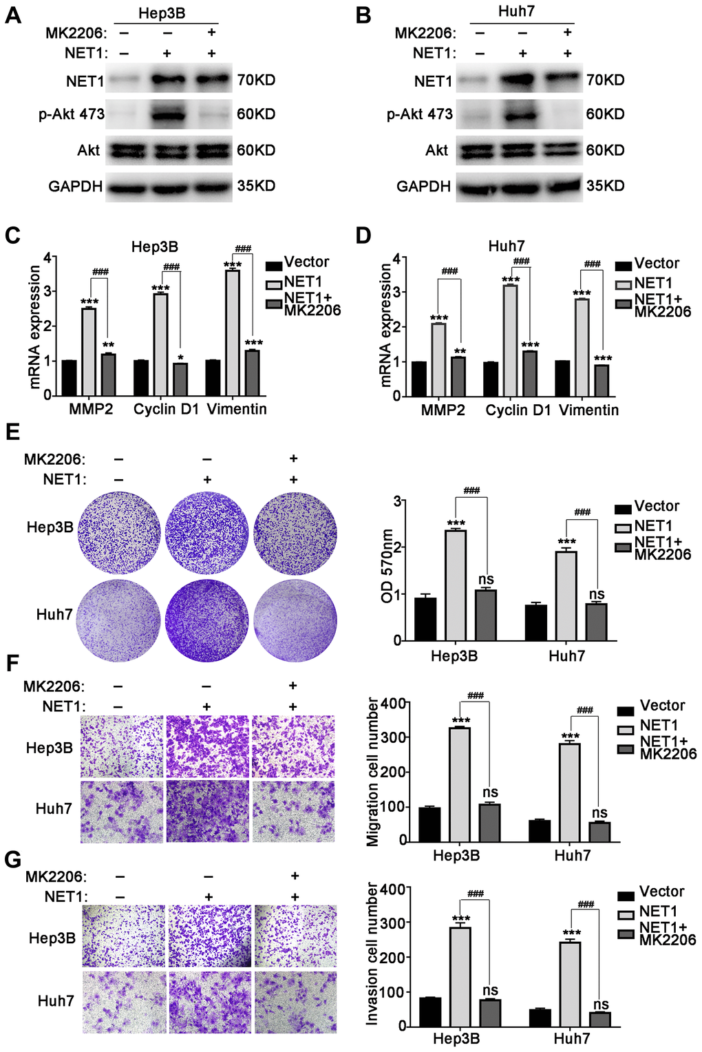 MK2206 inhibits Akt phosphorylation and reverses NET1 overexpression-induced HCC phenotype. (A and B) Western blot showing the inhibition of Akt phosphorylation by MK2206 in Hep3B (A) and Huh7 (B) cells with NET1 overexpression. (C and D) Real-time PCR showing the reversal of NET1-induced increased expression of MMP2, Cyclin D1 and Vimentin by MK2206 in Hep3B (C) and Huh7 (D) cells. (E) Crystal violet assays showing the reversal of NET1-induced cell growth by MK2206. Left panel: crystal violet assays. Right panel: measured OD values. (F) Transwell assays showing the reversal of NET1-induced cell migration by MK2206. Left panel: transwell assays. Right panel: calculation of cells that have migrated through the filter following eosin staining. (G) Transwell assays showing the reversal of NET1-induced cell invasion by MK2206. Left panel: transwell assays. Right panel: calculation of cells that have invaded through the filter following eosin staining. All data are presented as mean ± SE. ns not significant. **P ***P ###P 