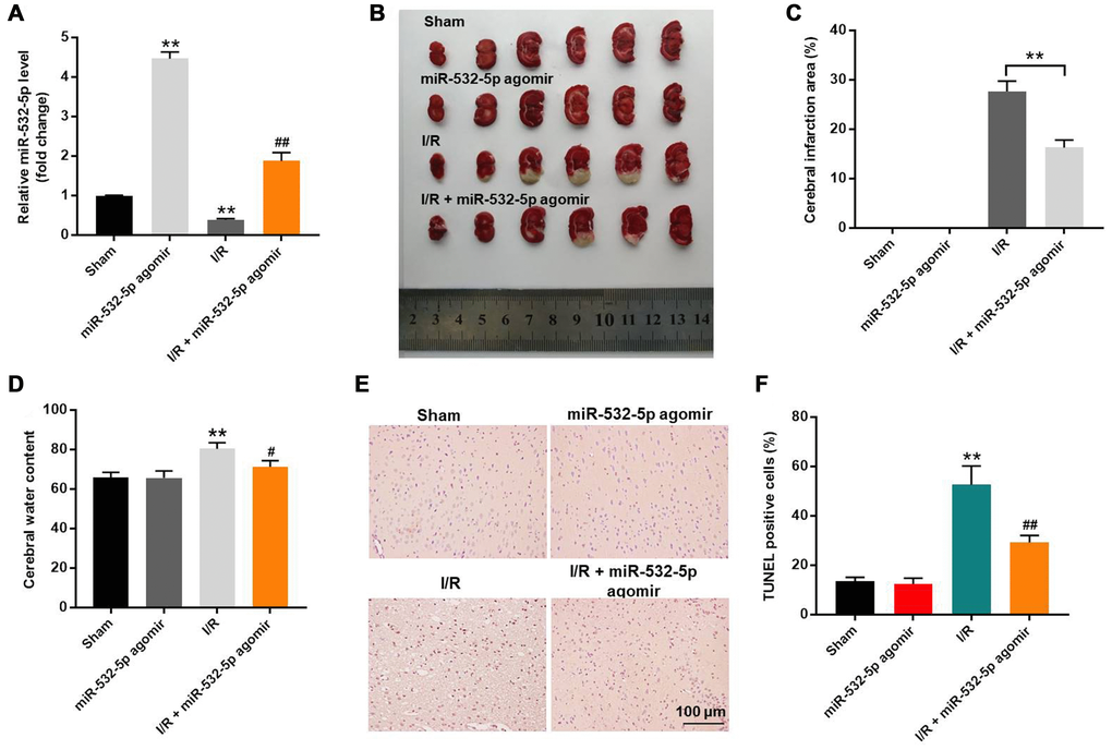 Overexpression of miR-532-5p reduces brain pathology in the in vivo CI/RI model rats. (A) RT-qPCR analysis shows the relative expression levels of miR-532-5p in the rat cerebral tissues in sham, miR-532-5p agomir, I/R and I/R plus miR-532-5p agomir groups. (B) Representative images show the brain tissues from sham, miR-532-5p agomir, I/R and I/R plus miR-532-5p agomir group rats. (C) Histogram plot shows cerebral infraction area based on TTC staining in sham, miR-532-5p agomir, I/R, and I/R plus miR-532-5p agomir group rats. **P D) The histogram plot shows cerebral water content in sham, miR-532-5p agomir, I/R and I/R plus miR-532-5p agomir group rats. (E, F) TUNEL staining results show the percentage of TUNEL-positive apoptotic neurons in the brain sections of sham, miR-532-5p agomir, I/R, and I/R plus miR-532-5p agomir group rats. **P #P ##P 