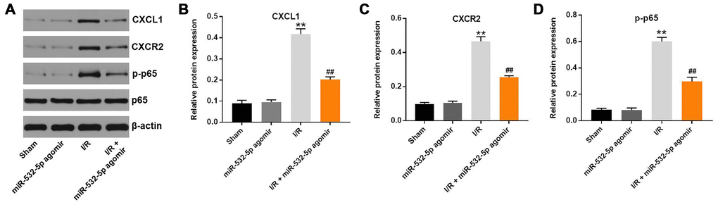 MiR-532-5p overexpression inhibits in vivo CI/RI through the CXCL1/CXCR2/NF-κB signaling pathway. (A) Representative western blot shows the expression levels of CXCL1, CXCR2, p65 and p-p65 proteins in brain tissues of sham, miR-532-5p agomir, I/R, and I/R plus miR-532-5p agomir group rats. (B–C) The histogram plots show the levels of CXCL1 and CXCR2 proteins relative to β-actin levels in brain tissues of sham, miR-532-5p agomir, I/R, and I/R plus miR-532-5p agomir group rats. (D) The histogram plot shows the levels of p-p65 relative to p65 in brain tissues of sham, miR-532-5p agomir, I/R, and I/R plus miR-532-5p agomir group rats. **P ##P 