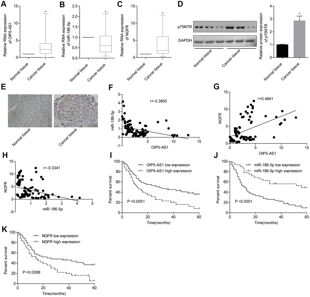 OIP5-AS1, NGFR and miR-186-5p are associated with prognosis in patients with pancreatic cancer. (A–D) Expression characteristics of OIP5-AS1, miR-186-5p and NGFR in pancreatic cancer patients. (E) Levels of p75NTR protein encoded by NGFR in pancreatic cancer and normal tissues (×100). (F–H) Correlation between the OIP5-AS1, miR-186-5p and NGFR levels. (I–K) Relationship between the OIP5-AS1, miR-186-5p and NGFR levels and survival rate in patients with pancreatic cancer.