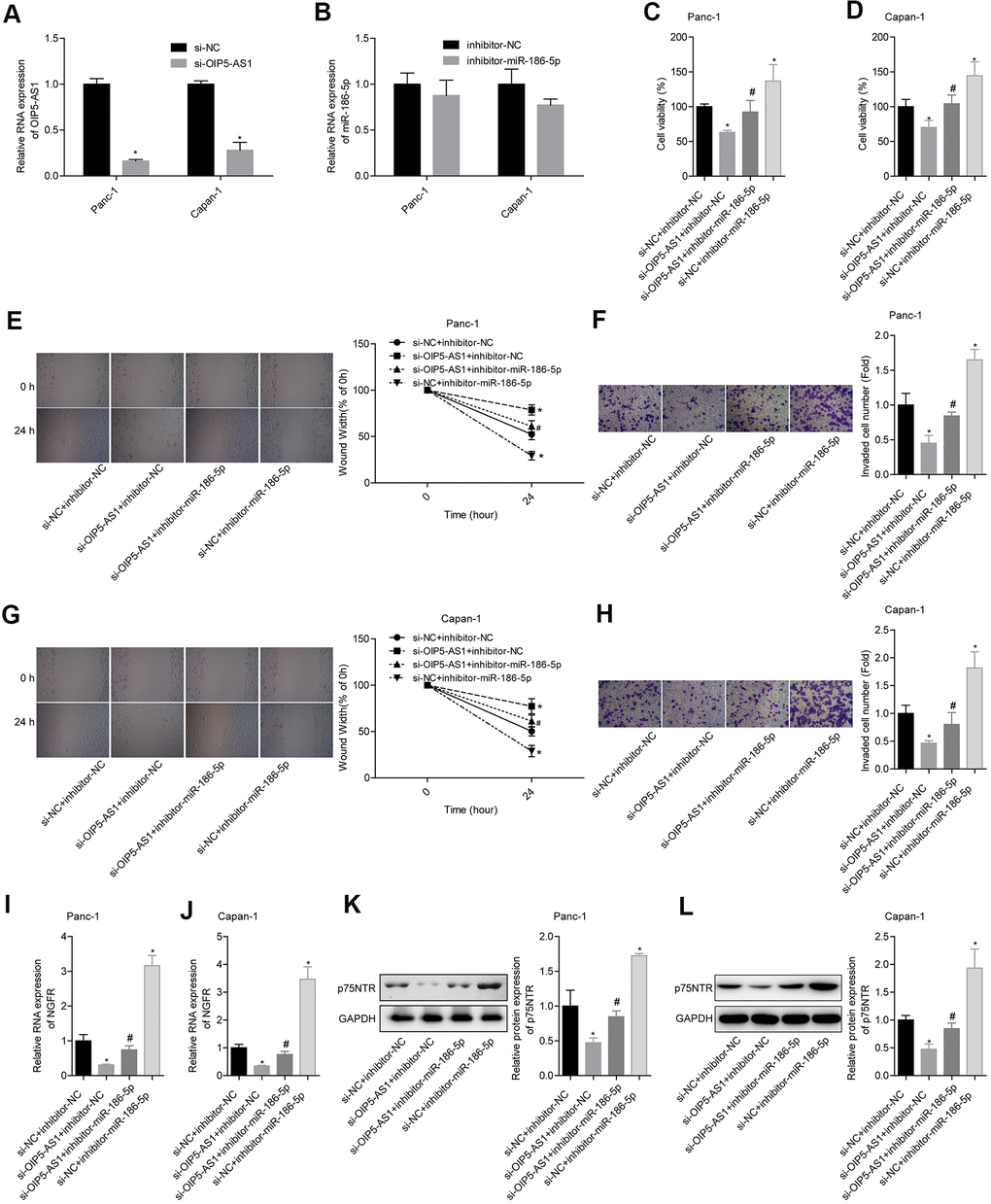 OIP5-AS1 promotes migration and invasion by targeting the miR-186-5p/NGFR axis. (A, B) Level of OIP5-AS1 and miR-186-5p protein after transfection. (C, D) Comparison of cell viability in each group. (E, F) Comparison of the migration and invasion abilities of Panc-1 cells in different groups. (G, H) Comparison of the migration and invasion abilities of Capan-1 cells in different groups. (I–L) Comparison of the NGFR mRNA and p75NTR protein levels in each group.