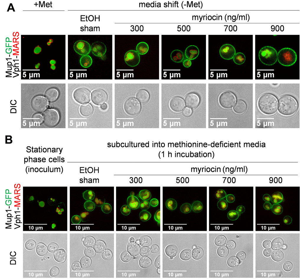 Mup1 biosynthesis and secretion appear unaffected by myriocin treatment. (A) JTY240 cells, with chromosomal copies of MUP1-GFP and VPH1-MARS, were gown to mid-log phase (A600nm = 0.4) and treated with Met (0.134 umol/L or 20 μg/ml) for 1 hour to deplete Mup1-GFP at the PM. Cells were washed with water, shifted to Met-deficient SC medium with or without Myr treatment for 1 hour and visualized by fluorescence microscopy. (B) JTY240 cells grown overnight in SC medium to stationary phase were washed with water and cultured (starting A600nm = 0.15) in fresh SC medium with or without Myr treatment.