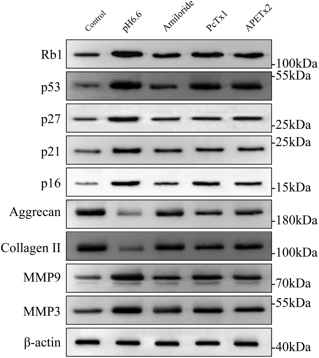 The effect of acidic culture conditions on senescence-related protein expression in primary cultured human NP-MSCs. Western blotting analyses were performed against Rb1, p53, p27, p21, p16, Aggrecan and Collagen II, MMP9 and MMP3 expression in Pfirrmann grade III NP-MSCs exposed to pH 6.6 culture conditions with or without treatment using the inhibitors Amiloride, PcTx1 or APETx2, respectively. The samples were from case 5, 9 and 12, respectively.