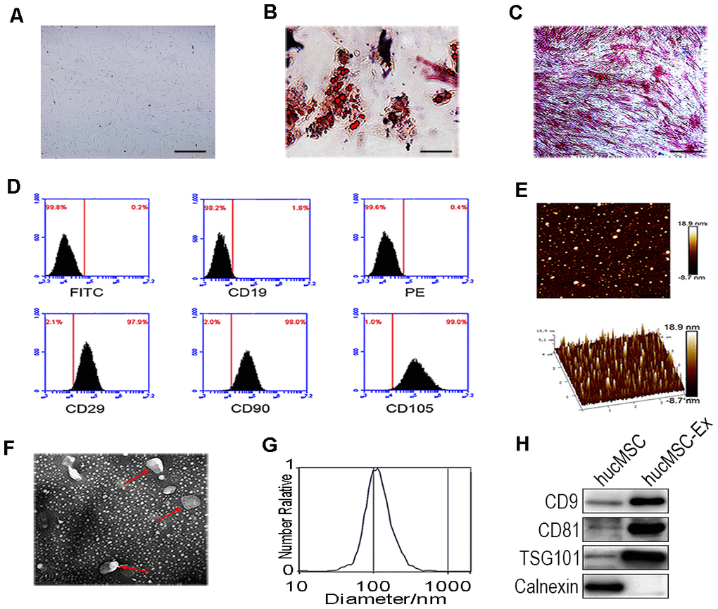 Identification of hucMSC and hucMSC-ex. (A) Morphological identification of hucMSC. (B) Adipogenic differentiation of hucMSC. Adipogenic differentiation was analyzed by Oil-Red-O staining. (C) Osteogenic differentiation of hucMSC was shown by neutrophil alkaline phosphatase (NAP) staining (100x). (D) Flow cytometry analyses of phenotypic markers of hucMSC:CD19, CD29, CD90, CD105. (E) Representative AFM image of hucMSC-ex. (F) Representative TEM image of hucMSC-ex (Scale bar=200 nm). (G) The hucMSC-ex size distribution were analyzed using nanoparticle tracking analysis (NTA) with ZetaView