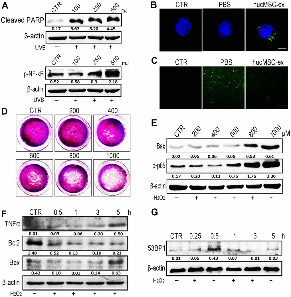 HucMSC-ex reduced UV-induced ROS production in vitro. (A) Western blot was used to detect the expression level of cleaved-PARP and p-NF-κB after different intensity of UV treatment. (B) Confocal microscopy observation of the internalization of PKH-67 labeled hucMSC-ex co-incubated with HaCaT for 12 hours. Original magnification (600x). (C) ROS production was detected by inverted fluorescence microscope after 500mJ UVB treatment of HaCaT cells (200x). (D) Crystal violet detected cell proliferation activity after HaCaT cells treatment with different concentration of H2O2. (E) Western blot analysis of Bax and p-NF-κB expression after HaCaT cells treatment with different concentrations of H2O2. (F) Western blot was used to detect the expression level of inflammatory cytokines and apoptosis in HaCaT cells treated with H2O2 at different times. (G) Western blot detection of 53BP1 expression level of H2O2 after HaCaT cells treatment at different times.