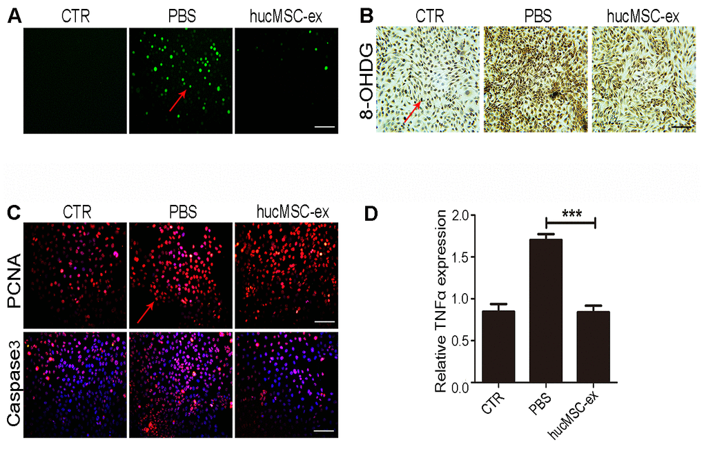 HucMSC-ex protect skin keratinocytes from oxidative stress. (A) The ROS production of HaCaT cells after 600μM H2O2 treatment was detected by the inverted fluorescence microscope. (B) Immunohistochemical staining of 8-OHDG expression level in HaCaT cells treated with 600μM H2O2. (C) Immunofluorescence detection of PCNA and Caspase3 expression level in HaCaT cells treated with 600μM H2O2. (D) qRT-PCR detection of the expression level of HaCaT cells inflammatory cytokines TNF-α (n = 3; *p 