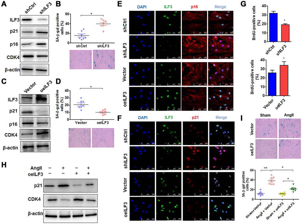 ILF3 overexpression suppresses Ang II-induced VSMC senescence. (A) Western blot detection of ILF3, p21, p16 and CDK4 expression in VSMCs transfected with shCtrl or shILF3. (B) SA-β-gal activity in VSMCs transfected with shCtrl or shILF3. The percentage of SA-β-gal positive cells (above) and representative pictures (below) are shown. Magnification × 400. *P C) Western blot detection of ILF3, p21, p16 and CDK4 expression in VSMCs transfected with empty vector or ILF3-expressing vector (oeILF3). (D) SA-β-gal activity in VSMCs transfected with empty vector or oeILF3. The percentage of SA-β-gal positive cells (above) and representative pictures (below) are shown. Magnification ×400. *P E) and (F) VSMCs were transfected with shILF3 or oeILF3 and their corresponding controls, and the expression of ILF3, p16 and p21 was examined by immunofluorescence staining. Green, red, and blue staining indicates ILF3, p16 (E), p21 (F) and the nuclei, respectively. Scale bar = 100 μm. (G) VSMCs were transfected as in (E), and cell proliferation was estimated by BrdU incorporation test. Graph presents means ± SD from at least three independent experiments. *P H) Western blot detection of p21 and CDK4 expression in VSMCs transfected with empty vector or oeILF3 followed by treatment with or without Ang II. (I) SA-β-gal activity in VSMCs transfected with empty vector or oeILF3 followed by treatment with or without Ang II. The percentage of SA-β-gal positive cells (bottom) and representative pictures (top) are shown. Magnification × 400. *P **P 