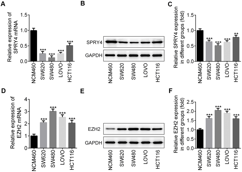 Differential expression of SPRY4 and EZH2 between colorectal cancer cells and normal human colon cell. From four human CRC cell lines, SW620, SW480, LOVO and HCT116, and a normal human colon mucosal epithelial cell line NCM460, we detected the mRNA level and protein expression of SPRY4 using western blotting and RT-qPCR, respectively (A–C). The mRNA level and protein expression of EZH2 were detected using western blotting and RT-qPCR, respectively (D–F). **, ***p