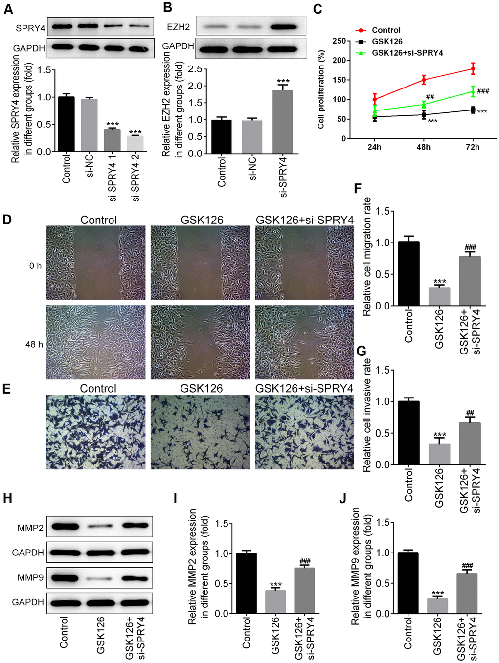 The function of SPRY4 silence on proliferation, migration and invasion in SW480 cells. SW480 cells were transfected with si-SPRY4 plasmid-1/2 and the empty plasmid, then the protein expression of SPRY4 in different groups was measured using western blotting (A). After transfection, the protein expression of EZH2 was also measured using western blot (B). ***PSPRY4. CCK-8 assay was conducted to determine cell proliferation ability (C). Wound-healing and Transwell assays were performed to determine cell migration and invasion abilities (D–G). The protein expression of MMP2 and MMP9 was measured using western blotting (H–J). ***p