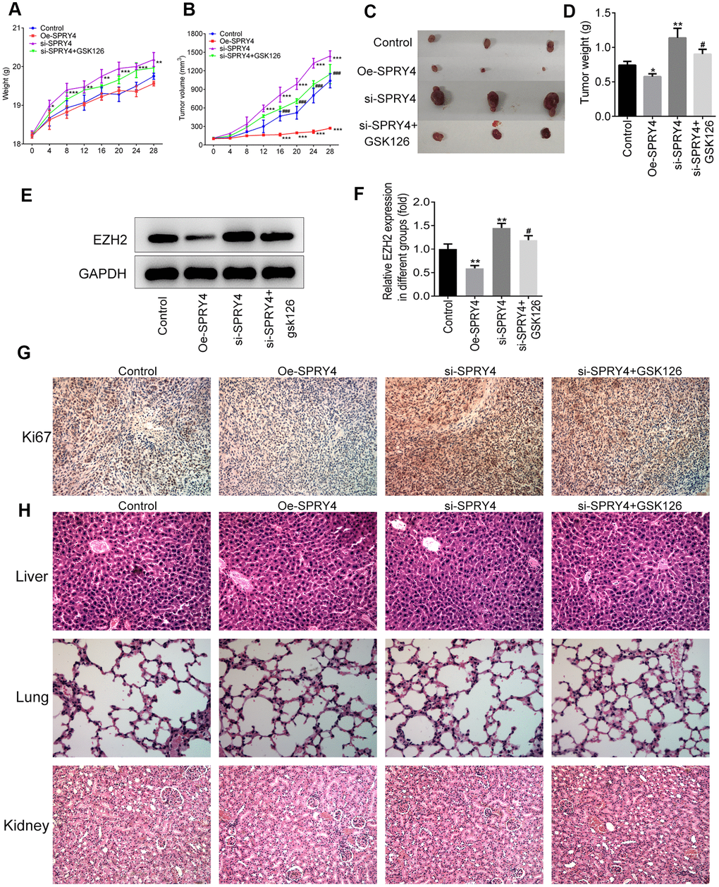 SPRY4 regulated tumorigenesis in vivo. The SW480 cells transfected with Oe-SPRY4 or si-SPRY4 were subcutaneously implanted into the axilla of the nude mice. The weight and tumor volume of mice were monitored every four days (A, B). After sacrifice, the total tumors were separated from the mice and were weighed (C, D). The protein expression of EZH2 in tumor tissues was detected using western blot (E, F). The expression of Ki67 was analyzed by immunohistochemistry (G). This histology of liver, lung and kidney was measured by H&E staining (H). *, **, ***pSPRY4.