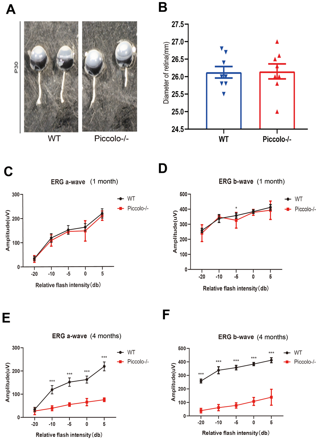 Structure and function of retina in wild type and Piccolo-/- mouse. (A) Eyes from wild type (WT) and Piccolo-/- mice. (B) Mean diameters of eyeballs from WT (n = 8) and Piccolo-/- (n = 8) mice. (C) ERG recording a-wave amplitudes from WT (n=6) and Piccolo-/- (n=6) mice at P30. (D) ERG recording b-wave amplitudes from WT (n=6) and Piccolo-/- (n=6) mice at P30. (E) ERG recording a-wave amplitudes from WT (n=6) and Piccolo-/- (n=6) mice at 4 months. (F) ERG recording b-wave amplitudes from WT (n=6) and Piccolo-/- (n=6) mice at 4 months. The asterisk indicates a significant difference between WT and Piccolo-/- mice. *P 