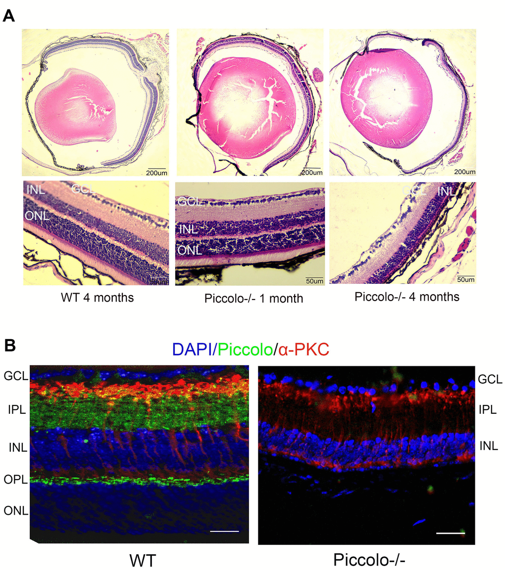 Retinal anatomy in Piccolo-/- mice. (A) H&E stained paraffin sections of retinas from Piccolo-/- and wild type (WT) mice. The image below represents the magnification of the upper image. (B) Immunofluorescence staining with DAPI, α-PKC (marker for bipolar cells), and anti-Piccolo antibodies in the retina of Piccolo-/- and WT mice. Scale bars: 20 μm.