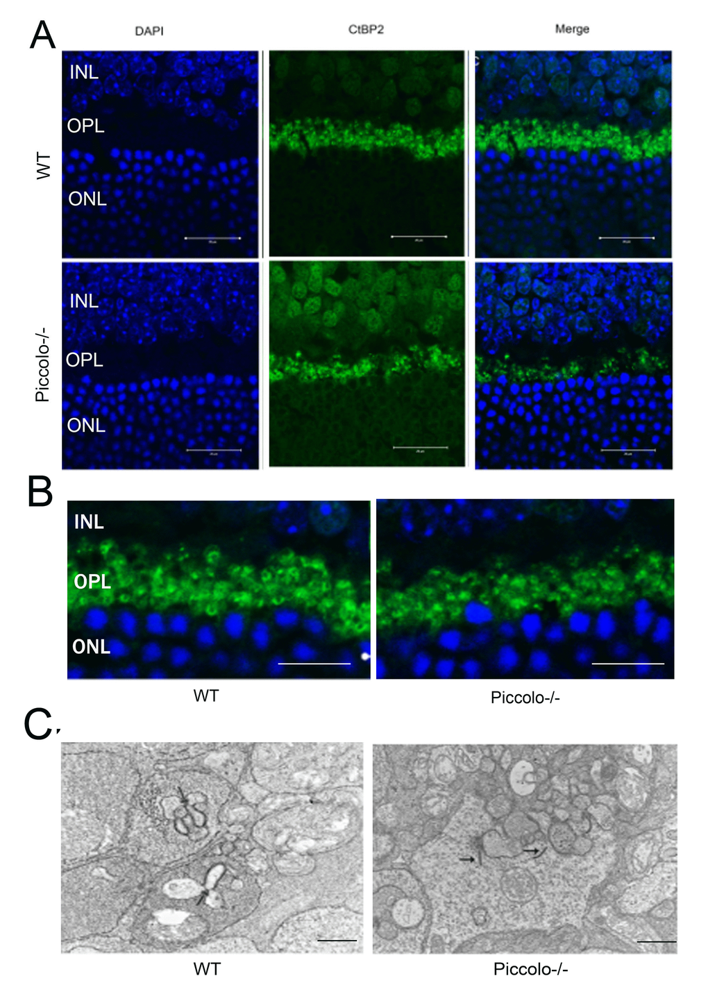 The morphology, location, and numbers of ribbon synapses in Piccolo-/- mice. (A) Immunostaining with anti-CtBP2 antibodies of retina cryosections from wild type (WT) and Piccolo-/- mice at P30. DAPI stains nuclei. Scale bars: 20 μm. (B) The morphology of ribbon synapses in the Piccolo-/- and WT mice. Scale bars: 10 μm. (C) The cytoplasmic location of retinal ribbon synapses (indicated by arrows) in Piccolo-/- mice. Scale bars: 1 μm.