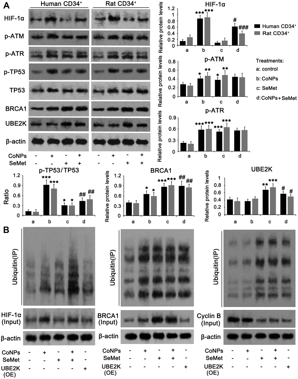 The regulatory effects of CoNPs and SeMet on DNA damage response signal. CD34+ HSC/HPCs were treated with 10 μM SeMet and 200 μM CoNPs, alone or in combination, followed by western blot (A) and Co-IP assay (B). In Co-IP assay, HIF-1α, BRCA1 and cyclin B proteins were immunoprecipitated and the enrichment of ubiquitin in these proteins was further determined by western blot. *p 