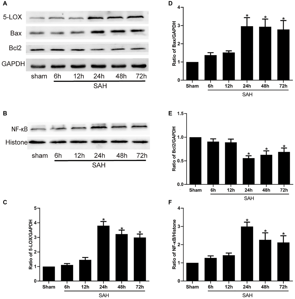 Levels of 5-LOX and NF-κB, Bax and Bcl2 protein at the indicated times after SAH. (A, B) Representative Western blots showing expression levels of 5-LOX, NF-κB, Bcl-2 and Bax. (C–F) Densitometric quantification of the protein bands. N = 6 in each group; *P 