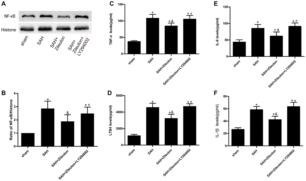 Zileuton suppresses expression of NF-κB, LTB4, TNF-α, IL-1β and IL-6 after SAH. (A, B) Representative images and the quantitative analysis of NF-κB after SAH in rats treat with Zileuton with or without LY294002 (n = 6 per group). (C–F) Effect of Zileuton with or without LY29400 on expression of LTB4, TNF-α, IL-1β and IL-6 after SAH (n = 6 in each group). *P &P #P 