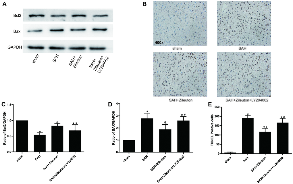 Zileuton suppresses neuronal apoptosis after SAH. (A, C, D) Effect of Zileuton with and without LY294002 on expression levels of pro-apoptotic Bax and anti-apoptotic Bcl-2 (n = 6 per group). *P &P #P B, E) TUNEL analysis of the effect of Zileuton with and without LY294002 on the incidence of apoptosis among neurons after SAH. Original magnification, 400×, n = 6 per group. *P &P #P 