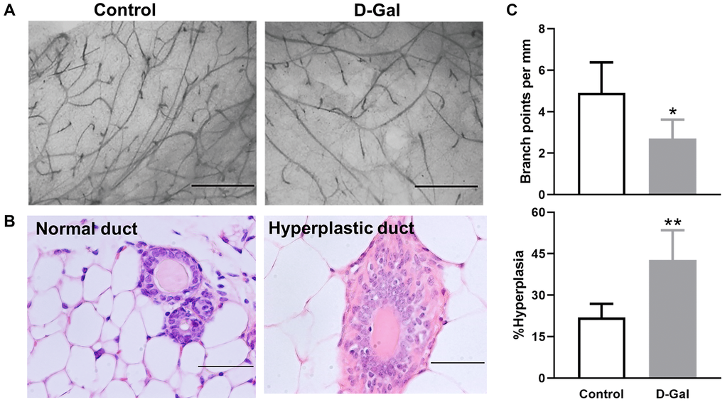 D-galactose affects mammary gland morphology and pathology. (A) Representative examples of whole mount carmine alum staining of mammary glands from control and D-galactose-treated mice (scale bars, 1 mm); (B) H&E histological images showing normal and hyperplastic ducts from control and D-galactose-treated mice (scale bars, 100 μm); (C) Quantification of branch points per millimeter (mm) duct (upper panel) and percent of hyperplastic ducts (lower panel) in control and D-galactose-treated mice (n = 5). Asterisks, significant difference between control and D-galactose (*P **P 