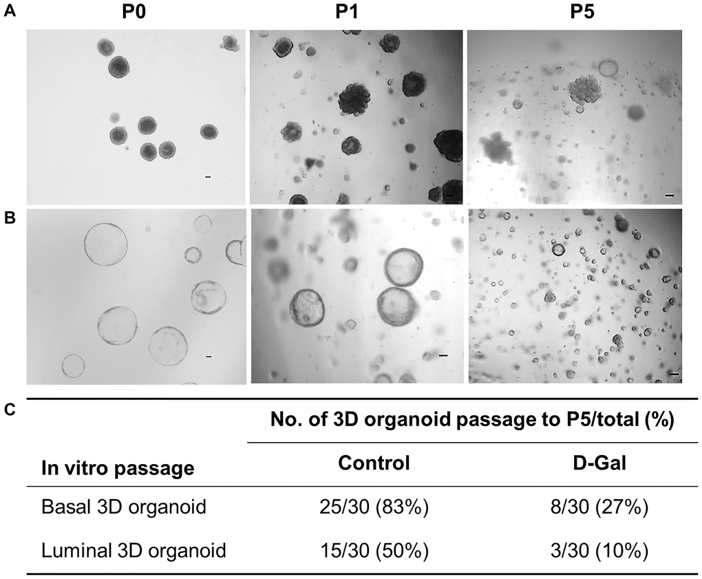 D-galactose alters mammary stem/progenitor cell function in vitro. (A) Representative images showing in vitro serial passage of basal stem cell contained 3D organoids from primary organoids (P0) to P1 and P5 (scale bars, 100 μm); (B) Representative images showing in vitro serial passage of luminal progenitor cell contained 3D organoids from primary organoids (P0) to P1 and P5 (scale bars, 100 μm); (C) Quantification of the number of 3D organoids that can be passaged to P5 for stem/progenitor cells derived from control and D-galactose-treated mice (for each type of 3D organoids, 10 organoids per animal × 3 animals = 30 organoids were assayed).