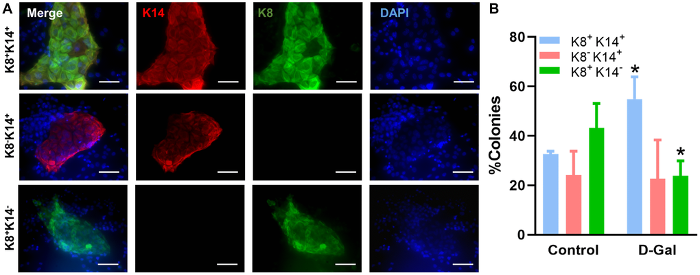 D-galactose alters luminal progenitor cell differentiation in vitro. (A) Representative immunofluorescence images showing distinct colonies formed by luminal progenitor cells on plates pre-seeded with irradiated NIH-3T3 fibroblasts; (B) Bar graph shows the distribution of different types of colonies formed by luminal progenitor from control and D-galactose-treated mice (> 20 colonies per animal × 3 animals). K14: basal cell marker keratin 14; K8: luminal cell marker keratin 8.