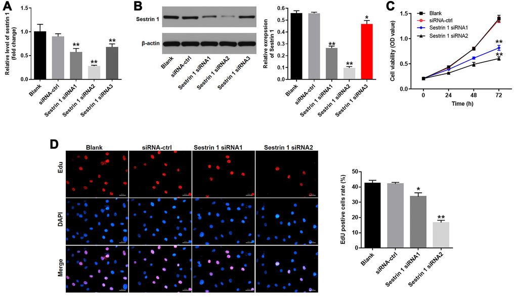 Downregulation of sestrin 1 inhibited proliferation of KGN cells. KGN cells were transfected with siRNA control, sestrin 1 siRNA 1, sestrin 1 siRNA2, or sestrin 1 siRNA3 for 48 h. Sestrin 1 silencing efficiency was detected by (A) RT-qPCR (B) and western blot. The effect of sestrin 1 downregulation on proliferation of KGN cells was determined using (C) a CCK-8 assay and (D) EdU fluorescence staining. EdU positive cells were counted. *P **P 