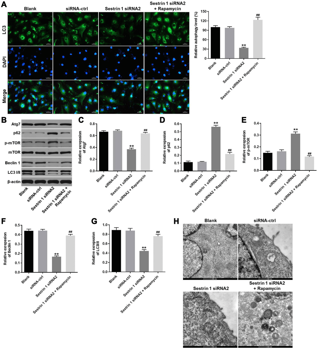 Sestrin 1 knockdown significantly inhibited autophagy in KGN cells. KGN cells were transfected with negative control (siRNA-ctrl) or Sestrin 1 siRNA2, and rapamycin was added 48 h after transfection. (A) Immunofluorescence staining for LC3 was used to evaluate the effects of sestrin 1 downregulation on autophagy in KGN cells by calculating the percentage of cells that were LC3 positive. (B) Western blots were performed to determine levels of Atg7, p62, p-mTOR, mTOR, Beclin 1 and LC3 I/II. β-actin was used as an internal control. (C–G) Atg7, p62, p-mTOR, Beclin 1 and LC3 I/II expressions were quantified. (H) The formation of autophagosome in each group was observed by the electron microscope. **P ##P 