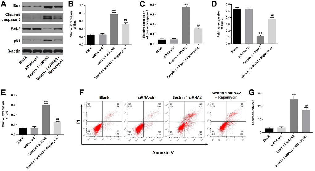 Sestrin 1 knockdown promoted apoptosis in KGN cells by inhibiting autophagy. (A) Western blots were performed to determine the levels of apoptosis associated proteins, including Bax, cleaved caspase 3, bcl-2, and p53. β-actin was used as an internal control. (B–E) Quantitative analysis of Bax, cleaved caspase 3, Bcl-2, and p53 expression in KGN cells. (F) Cell apoptosis was detected using annexin V/PI staining followed by flow cytometry. (G) Cell apoptosis rates were quantified. **P ##P 