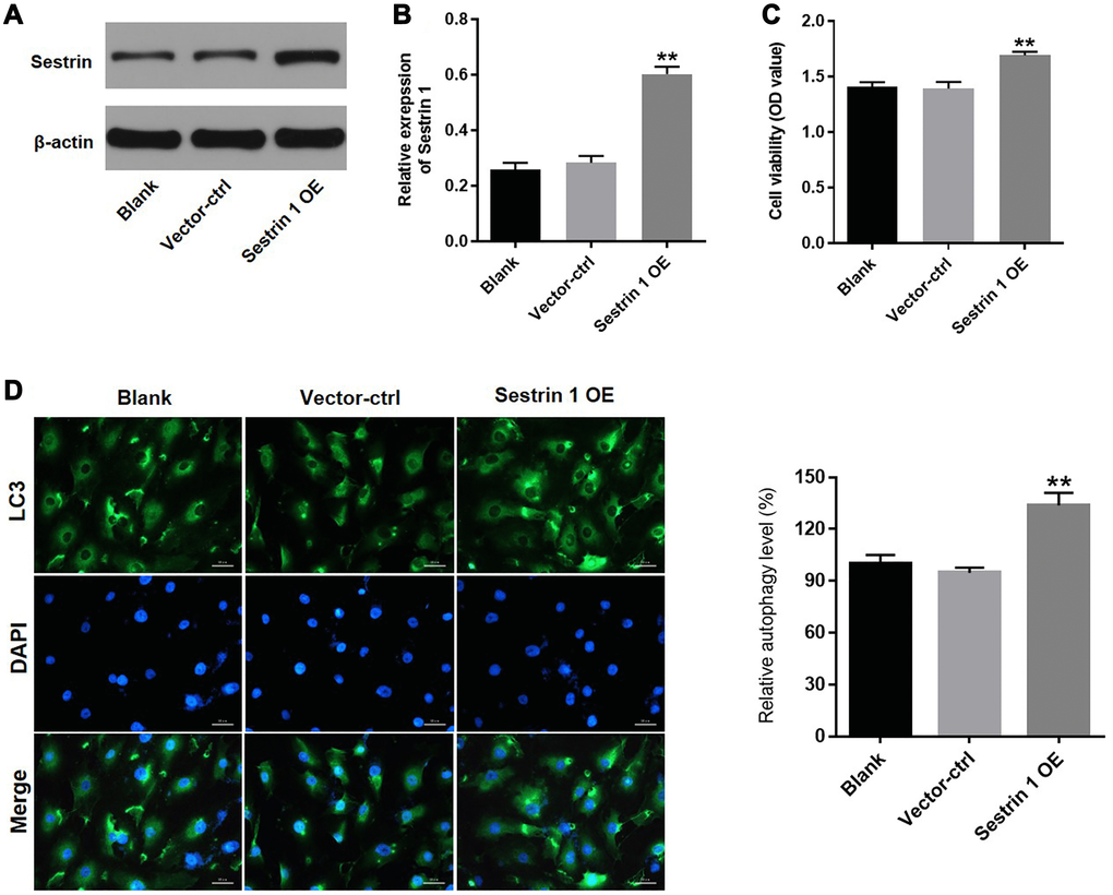 Sestrin 1 overexpression promoted proliferation of KGN cells by activating autophagy. KGN cells were transfected with sestrin 1 OE or vector-ctrl for 72 h respectively. (A) Sestrin 1 overexpression efficiency was evaluated by western blot. (B) Sestrin 1 expression was quantified. (C) The effect of sestrin 1 OE on proliferation of KGN cells was determined using a CCK-8 assay. (D) The effect of sestrin 1 OE on autophagy in KGN cells was determined using immunofluorescence staining for LC3. The percentage of LC3-positive cells indicates relative levels of autophagy. **P 