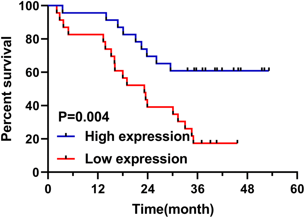 Relationship between miR-1228 in serum exosomes and survival patients. The overall survival in the low expression group was shortened.