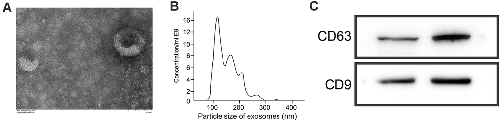 Identification of exosomes. (A) Morphology of exosomes under an electron microscope. (B) Analysis of particle size of exosomes by Brownian motion. (C) Quantification of CD63 and CD9 levels by WB.