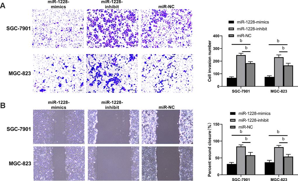 Effect of exosomal-miR-1228 derived from BM-MSCs on invasion and migration of gastric cancer cells. (A) After co-culture, the cells transfected with miR-1228-mimics had a decreased invasion, while those transfected with miR-1228-inhibit had an accelerated invasion. (B) After co-culture, the cells transfected with miR-1228-mimics had a decreased migration, while those transfected with miR-1228-inhibit had an accelerated migration. bPvs. miR-NC.
