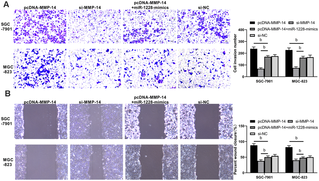Overexpression of miR-1228 inhibits MMP-14 upregulation-induced invasion and migration of gastric cancer cells. (A) The invasion of si-MMP-14 transfected cells was slowed down after co-culture, while that of sh-MMP-14 transfected cells was accelerated. The invasion of sh-MMP-14+miR-1228-mimics transfected cells had no difference from that of si-NC transfected cells. (B) After co-culture, the migration of si-MMP-14 transfected cells decreased while that of sh-MMP-14 transfected cells increased. bPvs. si-NC.